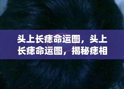 揭秘头上长痣命运图，痣相与人生轨迹的微妙联系探索命运密码